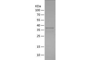 SERPINA1 Protein (AA 26-134) (His-IF2DI Tag)