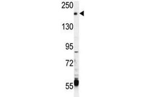 TRPM6 antibody western blot analysis in CEM lysate (TRPM6 抗体  (AA 317-348))