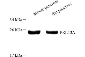 Western blot analysis of RPL13A (ABIN7075430) at dilution of 1: 800 (RPL13A 抗体)