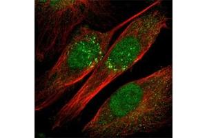 Immunofluorescence staining of U-251MG cell line with antibody shows positivity in nucleus and Golgi apparatus(green). (IL-18 抗体)