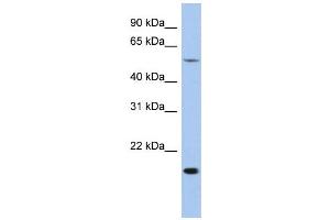 WB Suggested Anti-TEAD2 Antibody Titration: 0. (TEAD2 抗体  (Middle Region))