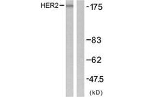 Western blot analysis of extracts from SK-OV3 cells, using HER2 (Ab-1221/1222) Antibody. (ErbB2/Her2 抗体  (AA 1191-1240))