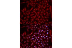 Immunofluorescence analysis of U2OS cells using CUL5 antibody (ABIN5973105). (Cullin 5 抗体)
