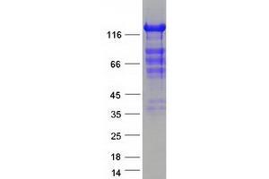 Western Blotting (WB) image for Caspase Recruitment Domain Family, Member 11 (CARD11) protein (Myc-DYKDDDDK Tag) (ABIN2713159)