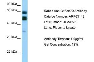 Western Blotting (WB) image for anti-Chromosome 16 Open Reading Frame 70 (C16orf70) (C-Term) antibody (ABIN2789391) (C16orf70 抗体  (C-Term))