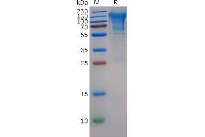 SDS-PAGE (SDS) image for CD68 Molecule (CD68) (AA 22-319) protein (His tag) (ABIN7092757)