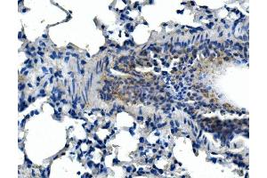 IHC analysis of Adam28 using anti-Adam28 antibody (ABIN7600945).