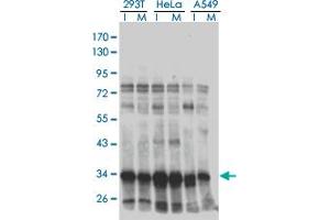 Western blot analysis of HMG20B in extracts from 293T, HeLa and A549 cell using anti-HMG20B monoclonal antibody. (HMG20B 抗体  (AA 1-109))