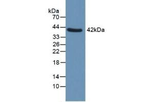 Detection of QPCT in Human Uterus using Polyclonal Antibody to Glutaminyl Peptide Cyclotransferase (QPCT) (QPCT 抗体  (AA 29-361))