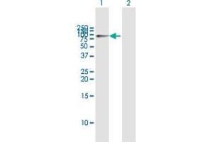 Western Blot analysis of HK1 expression in transfected 293T cell line by HK1 MaxPab polyclonal antibody. (Hexokinase 1 抗体  (AA 1-916))