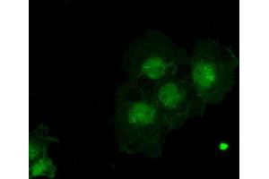 Immunofluorescence (IF) image for anti-alpha-Fetoprotein (AFP) (AA 19-397) antibody (ABIN2716009)