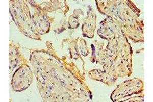 Immunohistochemistry (IHC) image for anti-Potassium Intermediate/small Conductance Calcium-Activated Channel, Subfamily N, Member 4 (KCNN4) (AA 288-427) antibody (ABIN7156944)