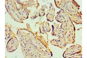 Immunohistochemistry of paraffin-embedded human placenta tissue using ABIN7156944 at dilution of 1:100 (KCNN4 抗体  (AA 288-427))