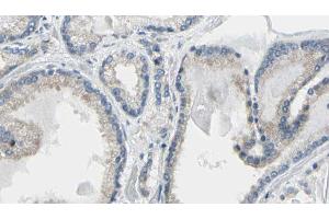ABIN6274218 at 1/100 staining Human prostate tissue by IHC-P. (Calreticulin 抗体  (N-Term))