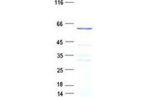 Validation with Western Blot