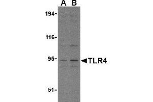 Western Blotting (WB) image for anti-Toll-Like Receptor 4 (TLR4) (N-Term) antibody (ABIN1031622) (TLR4 抗体  (N-Term))