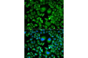 Immunofluorescence analysis of A549 cells using UBE2H antibody (ABIN4905537). (UBE2H 抗体)