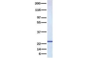 Validation with Western Blot