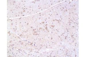 Formalin-fixed and paraffin embedded: rat brain tissue labeled with Anti-PMP22 Polyclonal Antibody, Unconjugated  at 1:200, followed by conjugation to the secondary antibody and DAB staining (PMP22 抗体  (AA 101-160))