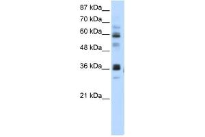 RPUSD2 antibody used at 5 ug/ml to detect target protein. (RPUSD2 抗体  (N-Term))