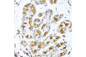 Immunohistochemistry of paraffin-embedded human stomach using PIAS3 antibody at dilution of 1:100 (40x lens). (PIAS3 抗体)