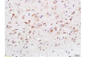 Paraformaldehyde-fixed, paraffin embedded (Species/Tissue), Antigen retrieval by boiling in sodium citrate buffer (pH6) for 15min, Block endogenous peroxidase by 3% hydrogen peroxide for 30 minutes, Blocking buffer (normal goat serum) at 37°C for 20min, Antibody incubation with Calcium Sensing Receptor Polyclonal Antibody, Unconjugated  at 1:500 overnight at 4°C, followed by a conjugated secondary and DAB staining. (CASR 抗体  (AA 121-220))