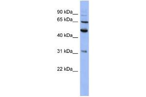 Western Blotting (WB) image for anti-Proteasome (Prosome, Macropain) 26S Subunit, Non-ATPase, 3 (PSMD3) (N-Term) antibody (ABIN2786726)