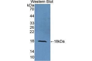 Detection of Recombinant UCRP, Human using Polyclonal Antibody to Ubiquitin Cross Reactive Protein (UCRP) (ISG15 抗体  (AA 2-157))