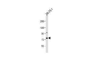 Anti-CTTNBP2NL Antibody (N-term) at 1:1000 dilution + ZR-75-1 whole cell lysate Lysates/proteins at 20 μg per lane. (CTTNBP2NL 抗体  (N-Term))