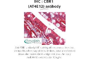 Image no. 1 for anti-Carbonyl Reductase 1 (CBR1) antibody (ABIN1724380) (CBR1 抗体)