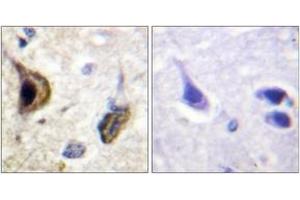 Immunohistochemistry (IHC) image for anti-Potassium Inwardly-Rectifying Channel, Subfamily J, Member 16 (KCNJ16) (AA 369-418), (pSer417) antibody (ABIN1531680)