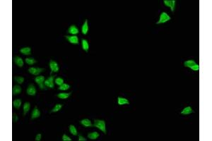 Immunofluorescence staining of Hela cells with ABIN7153030 at 1:133, counter-stained with DAPI. (FOXD3 抗体  (AA 1-140))