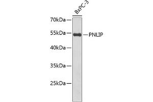 Western blot analysis of extracts of BxPC-3 cells, using PNLIP antibody  at 1:1000 dilution. (PNLIP 抗体  (AA 166-465))