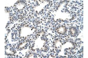 SLC10A5 antibody was used for immunohistochemistry at a concentration of 4-8 ug/ml to stain Alveolar cells (arrows) in Human Lung. (SLC10A5 抗体)