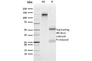 SDS-PAGE Analysis Purified n-Myc Mouse Monoclonal Antibody (NMYC-1). (MYCN 抗体)