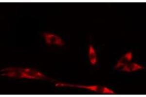 ABIN6275011 staining LOVO cells by IF/ICC. (CHPF 抗体  (C-Term))