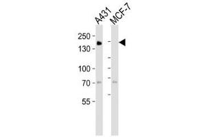 Western blot analysis of lysate from A431, MCF-7 cell line (left to right) using EGF Receptor antibody at 1:1000 for each lane.