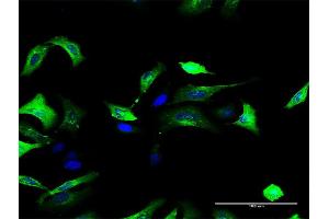 Immunofluorescence of purified MaxPab antibody to FOLR1 on HeLa cell. (FOLR1 抗体  (AA 1-257))