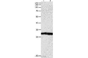 Western blot analysis of Jurkat cell and human fetal kidney tissue, using DUSP6 Polyclonal Antibody at dilution of 1:450 (DUSP6 抗体)