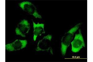 Immunofluorescence of purified MaxPab antibody to USP10 on HeLa cell. (USP10 抗体  (AA 1-798))