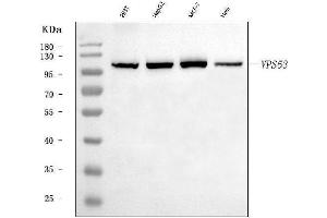 Western blot analysis of VPS53 using anti-VPS53 antibody (ABIN7599731).