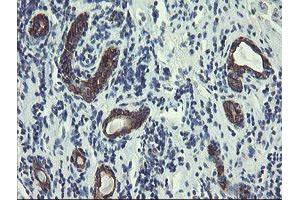 Image no. 7 for anti-Diphthamide Biosynthesis Protein 2 (DPH2) antibody (ABIN1497891)