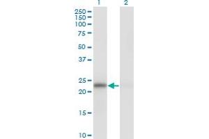 Western Blot analysis of MAD2L1 expression in transfected 293T cell line by MAD2L1 monoclonal antibody (M01), clone 2E2-1D6. (MAD2L1 抗体  (AA 1-205))