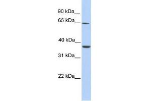 Human Liver; WB Suggested Anti-ZNF677 Antibody Titration: 0. (ZNF677 抗体  (C-Term))
