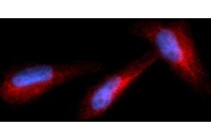 Immunofluorescence (IF) image for anti-Granzyme B (GZMB) (AA 21-247) antibody (PE) (ABIN5564764) (GZMB 抗体  (AA 21-247) (PE))