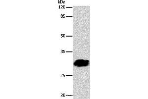 Western blot analysis of 293T cell, using GJB6 Polyclonal Antibody at dilution of 1:1040 (GJB6 抗体)