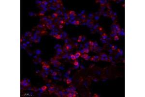 Immunofluorescence of paraffin embedded mouse lung using ARHGAP18 (ABIN7075417) at dilution of 1: 700 (450x lens) (ARHGAP18 抗体)