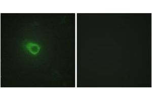 Immunofluorescence analysis of HeLa cells, using JAK1 Antibody. (JAK1 抗体  (AA 91-140))