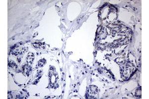 Image no. 4 for anti-TIA1 Cytotoxic Granule-Associated RNA Binding Protein (TIA1) antibody (ABIN1501387)