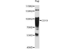 Western blot analysis of extracts of Raji cells, using CD19 Antibody (ABIN5971402) at 1:3000 dilution. (CD19 抗体)